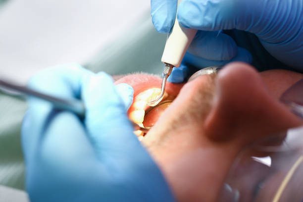 Best Emergency Treatment for Oral Infections in Douglass, KS